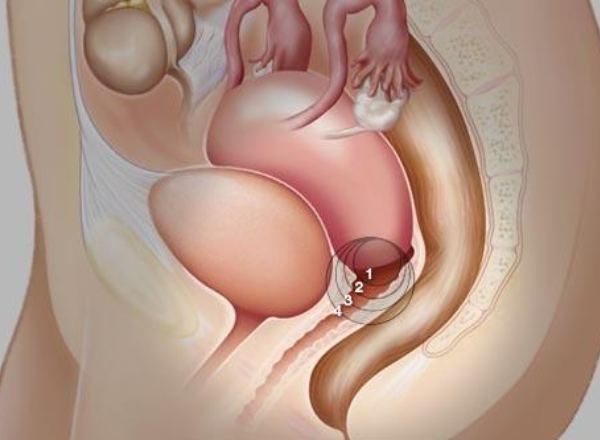 <b>试管移植一个胚胎会可能双胎</b>