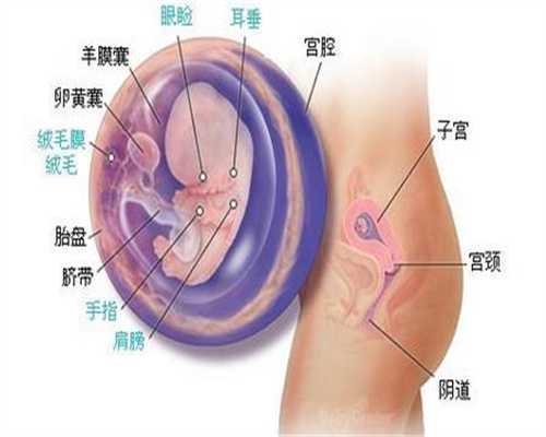 北京代孕程序-供卵生的孩子像自己吗_北京确认3例“脊灰”病毒感染 此前27年无